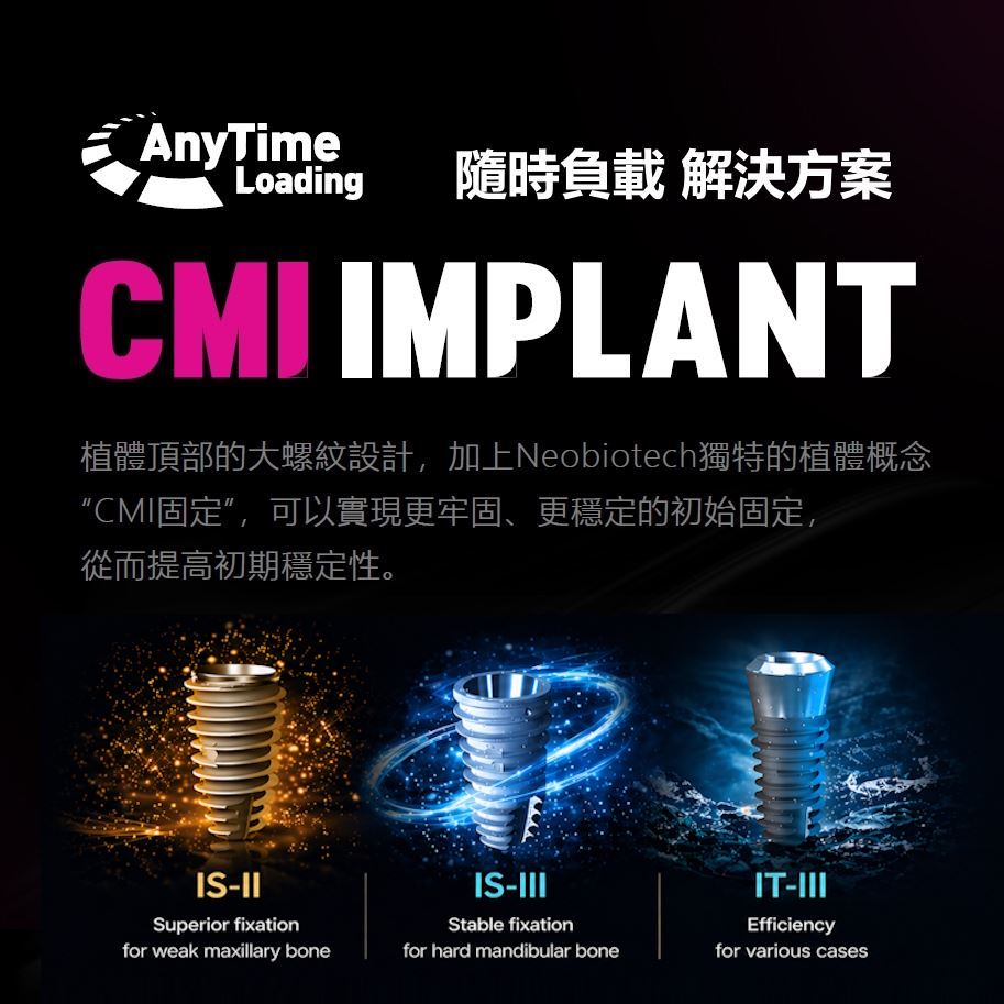 CMI固定理論 & Anytime Loading 隨時負載 & CMI植體